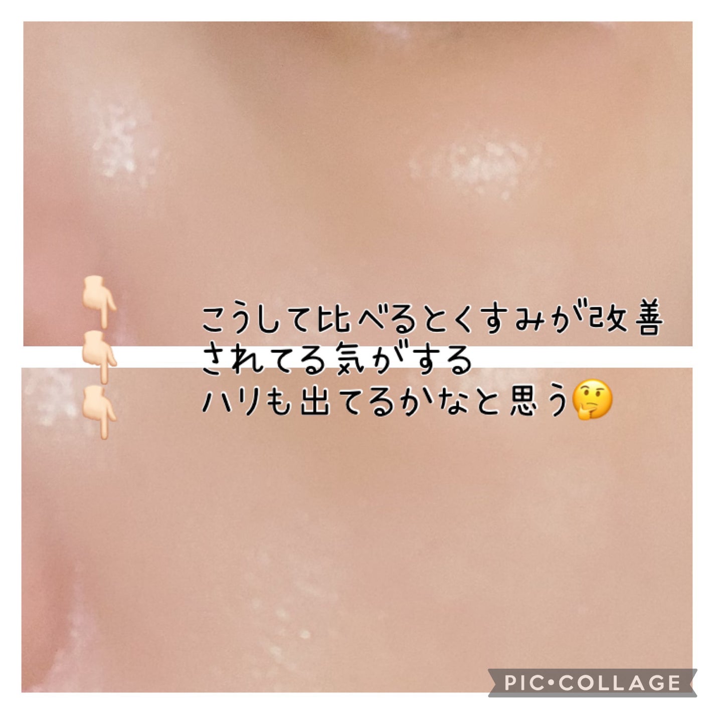 リードルショット300/VT/美容液を使ったクチコミ(7枚目)