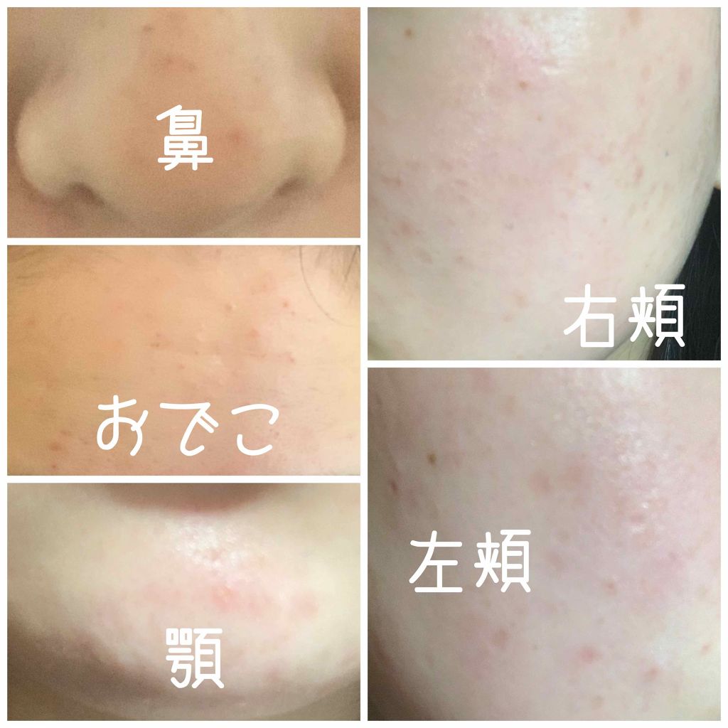 精製水（医薬品）/健栄製薬/その他を使ったクチコミ（2枚目）