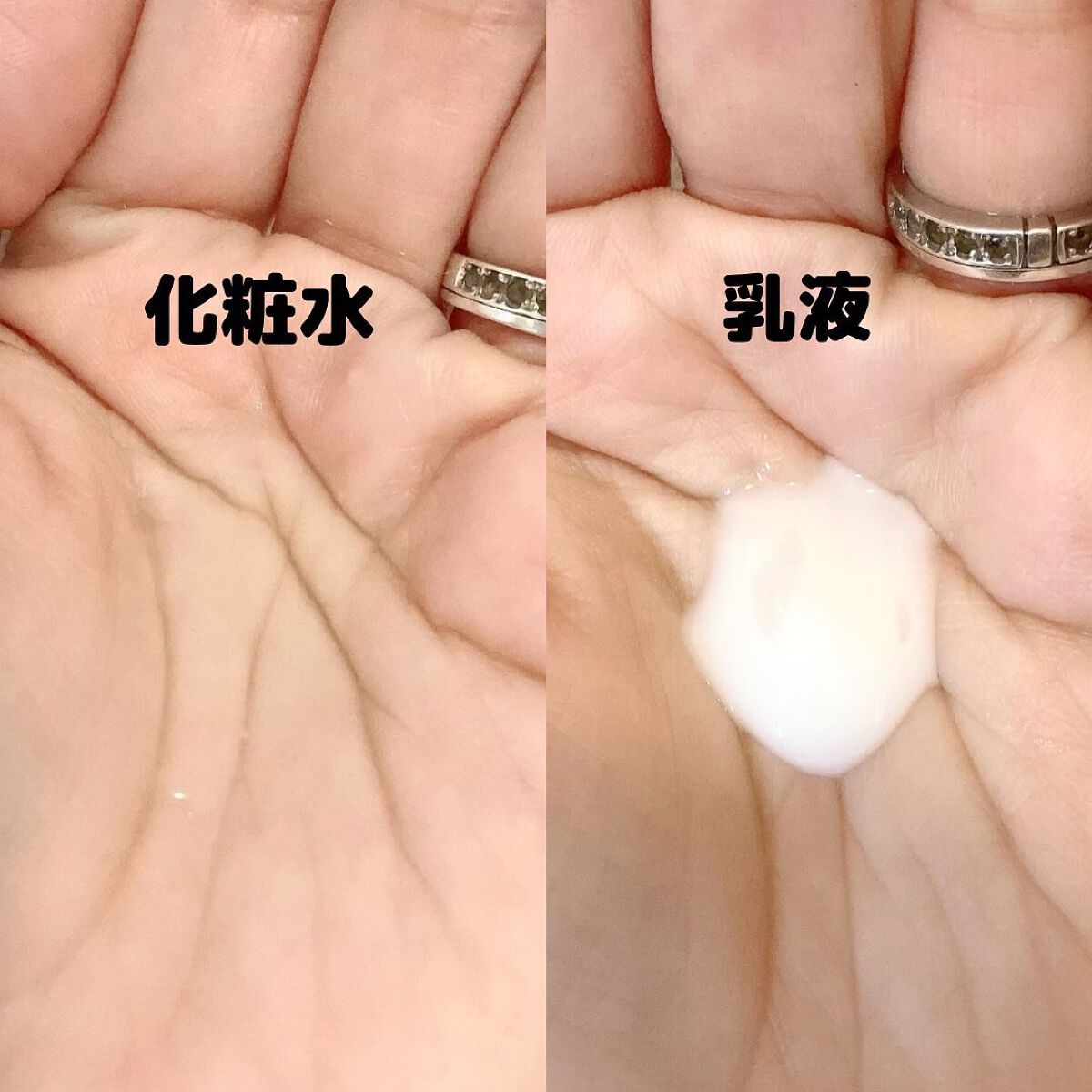 ル・マイルド化粧水/ル・マイルド/化粧水を使ったクチコミ(3枚目)