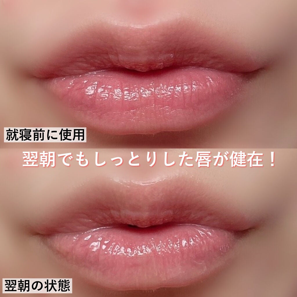 リップケア バーム/キュレル/リップバームを使ったクチコミ(8枚目)