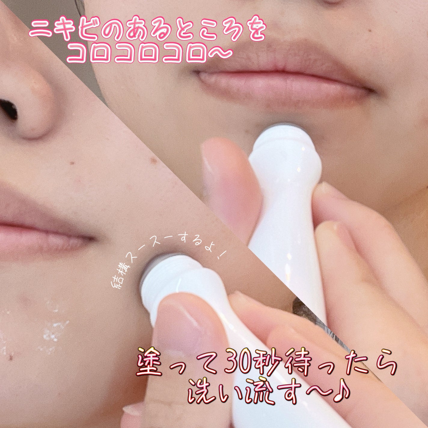 ABC クリアトック/P.CALM/洗い流すパック・マスクを使ったクチコミ(2枚目)