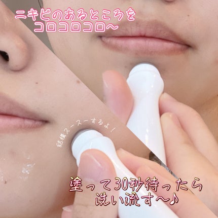 ABC クリアトック/P.CALM/洗い流すパック・マスクを使ったクチコミ(2枚目)