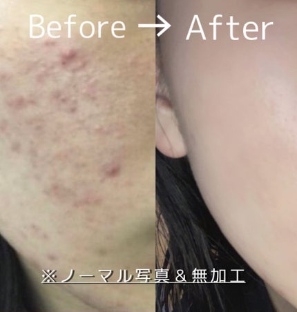 なめらか本舗 乳液 NA/なめらか本舗/乳液を使ったクチコミ(1枚目)