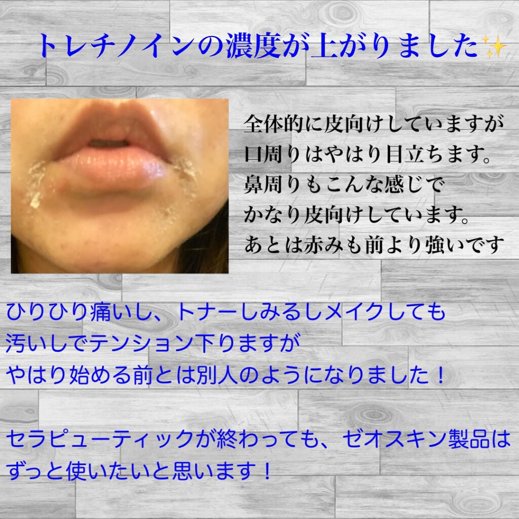 RCクリーム/ZO Skin Health/フェイスクリームを使ったクチコミ(4枚目)