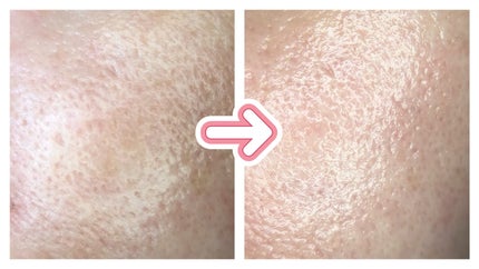 3番 すべすべキメケアシートマスク/numbuzin/シートマスク・パックを使ったクチコミ(2枚目)