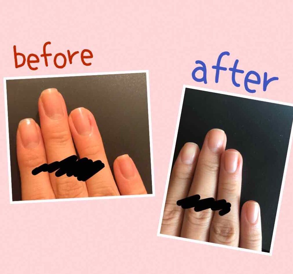 ベルベットスムーズ　電動ネイルケアキット/ドクター・ショール/ネイル用品を使ったクチコミ（2枚目）