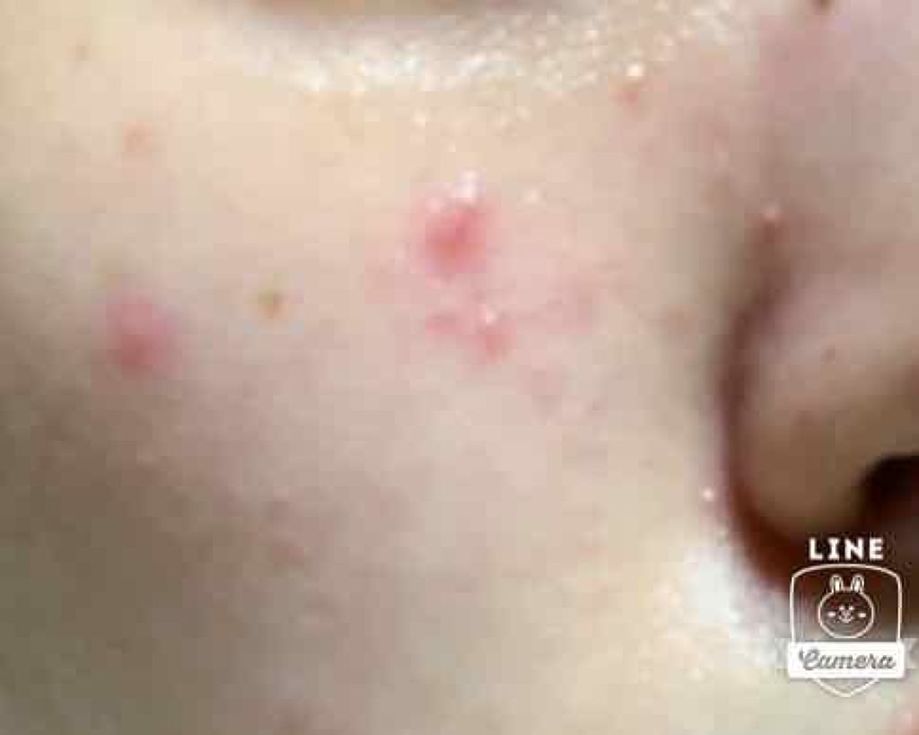 薬用化粧水/スキンライフ/化粧水を使ったクチコミ(1枚目)