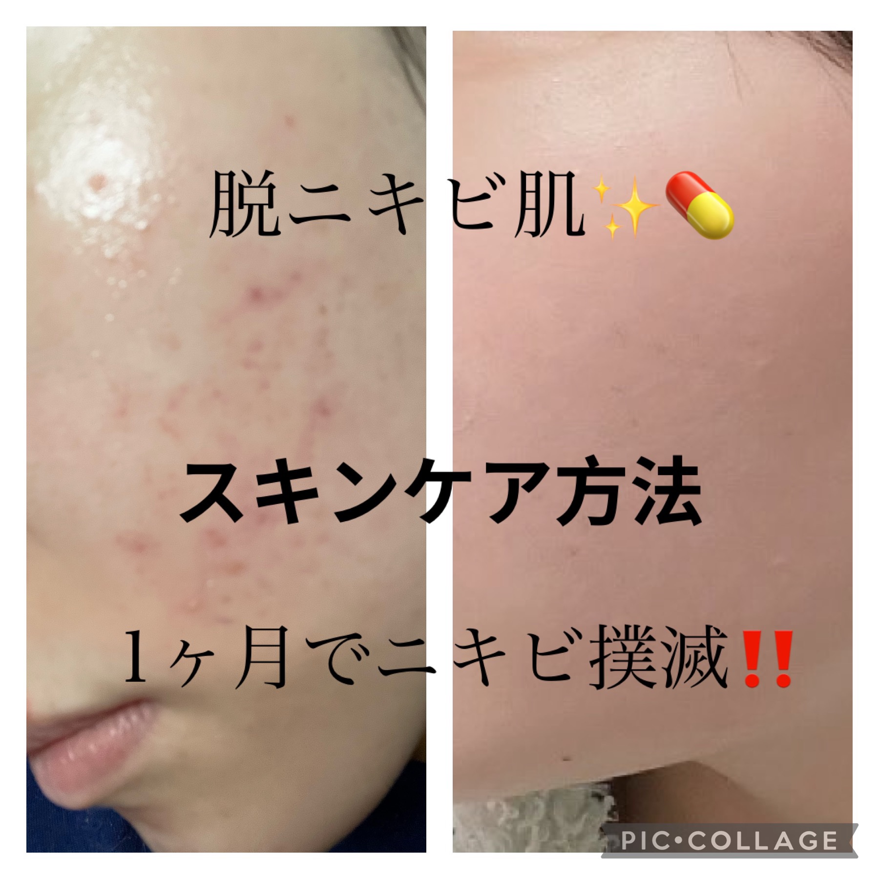 プリズム・リーブル・スキンケアリング・コンシーラー/GIVENCHY/リキッドコンシーラーを使ったクチコミ（1枚目）