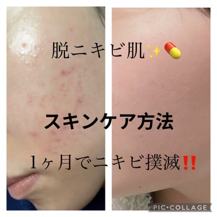 プリズム・リーブル・スキンケアリング・コンシーラー/GIVENCHY/リキッドコンシーラーを使ったクチコミ(1枚目)