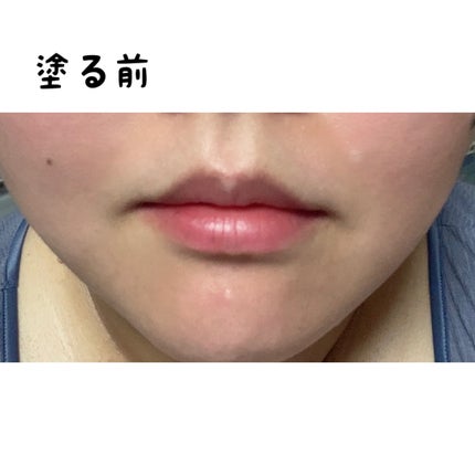 ドトムリッププラスプランパー/keybo/リッププランパーを使ったクチコミ(4枚目)