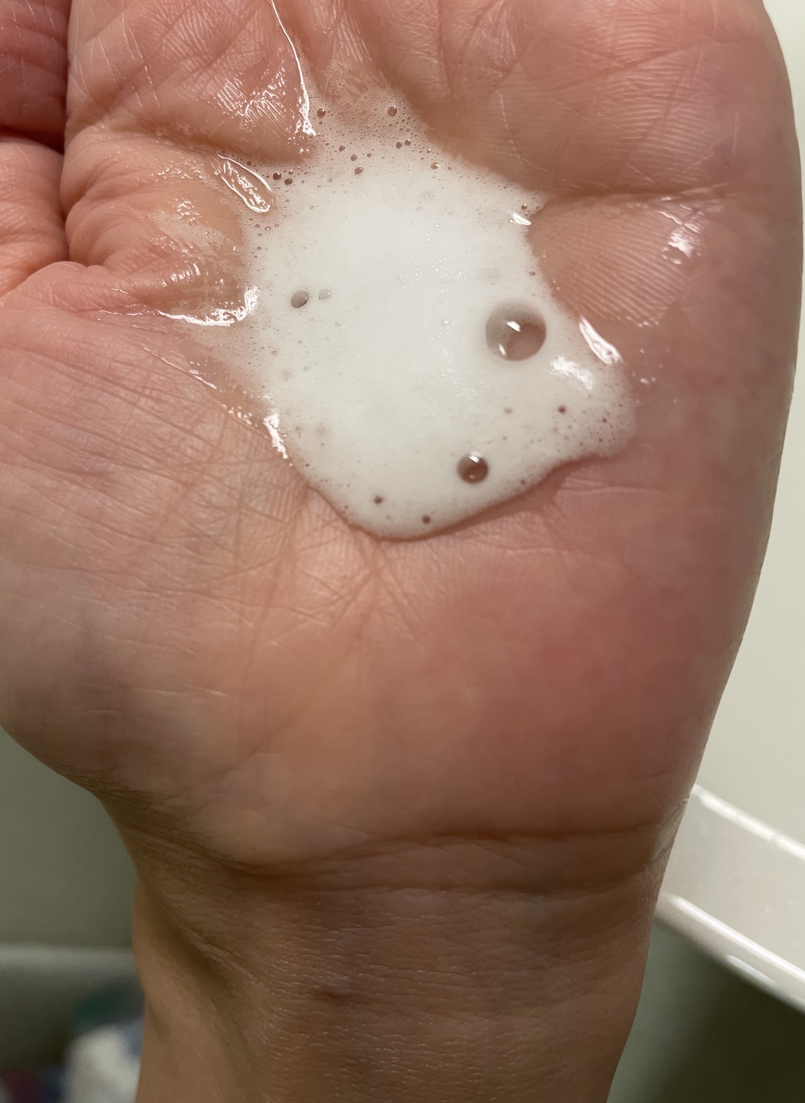 フェルゼアプレミアム 薬用泡の化粧水/フェルゼア/化粧水を使ったクチコミ（3枚目）