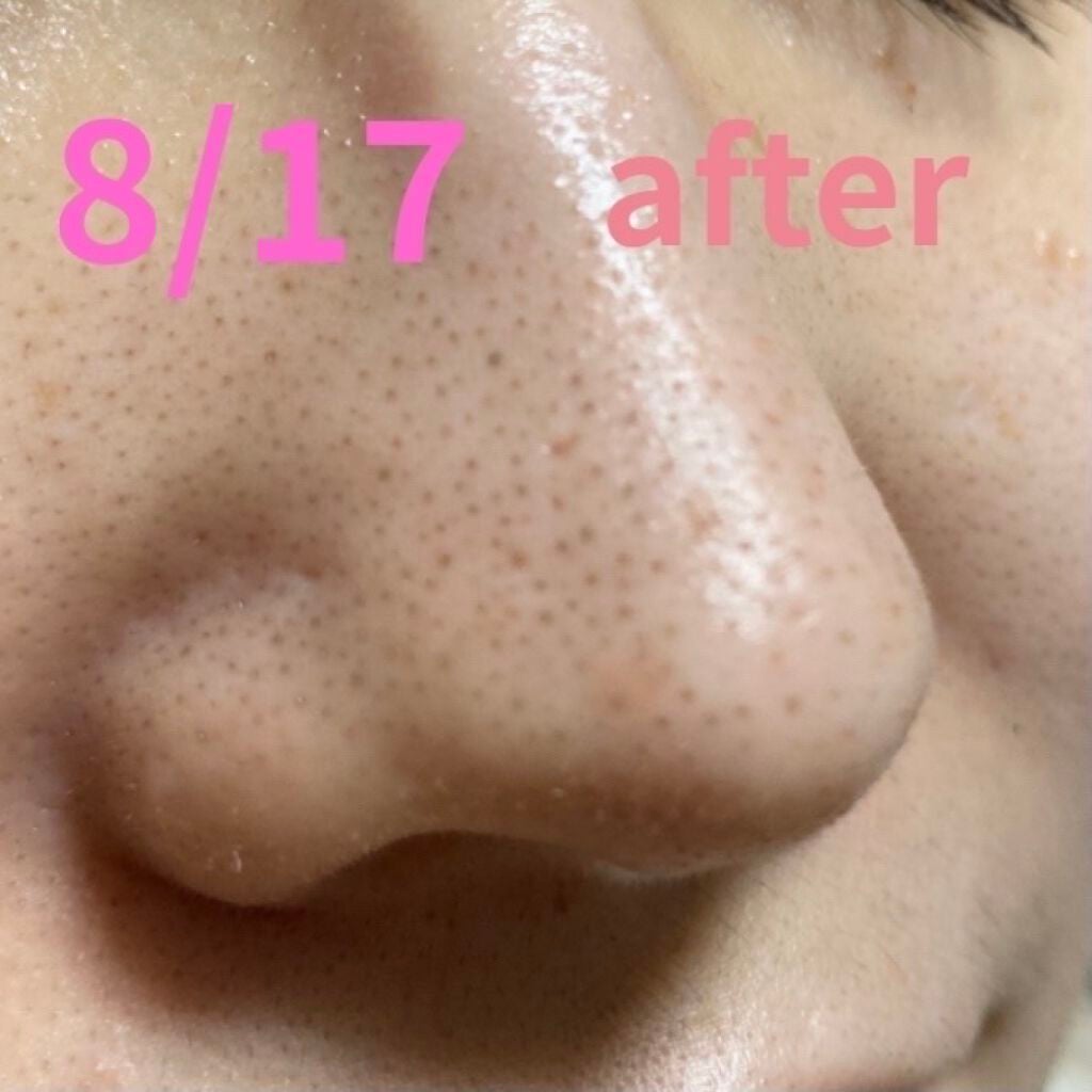 デュオ ザ クレンジングバーム ブラック/DUO/クレンジングバームを使ったクチコミ(4枚目)