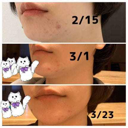 化粧水・敏感肌用・高保湿タイプ/無印良品/化粧水を使ったクチコミ(4枚目)