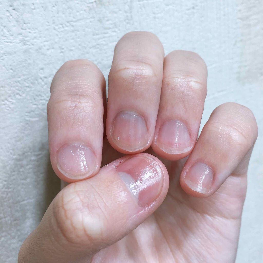 ネイルケアオイル/無印良品/ネイルオイル・トリートメントを使ったクチコミ(2枚目)