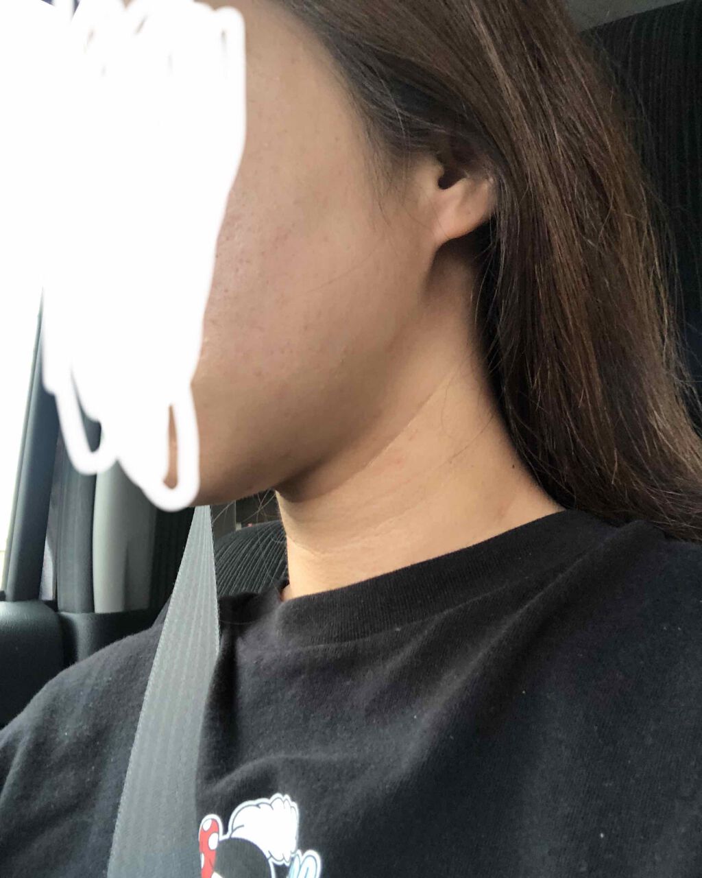 薬用泡のふんわり洗顔/スキンライフ/泡洗顔を使ったクチコミ（2枚目）