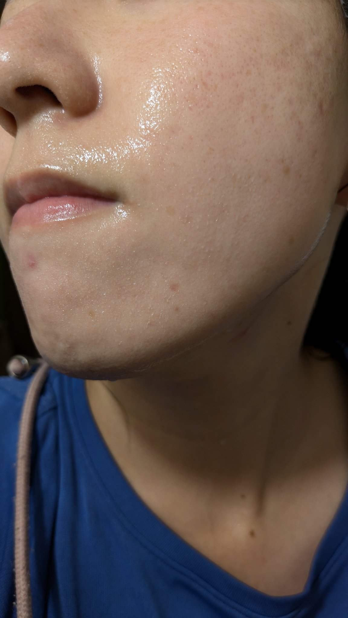 A2+NAG2ソリューション/The Ordinary/美容液を使ったクチコミ（2枚目）