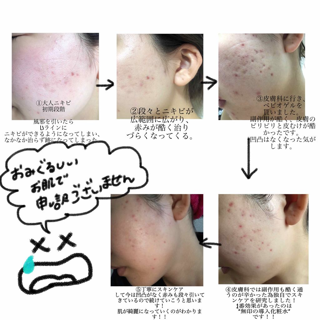 化粧水・敏感肌用・高保湿タイプ/無印良品/化粧水を使ったクチコミ（2枚目）