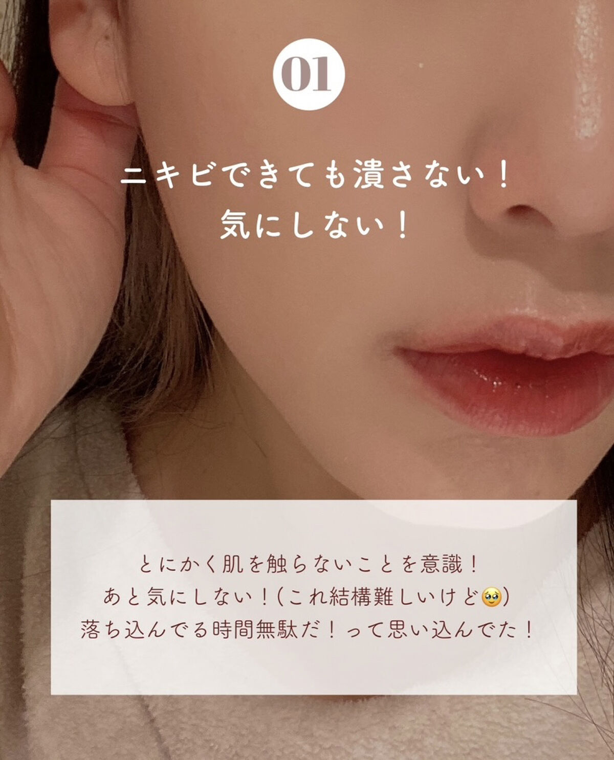 セラミドスキンケア 薬用アクネVCローション/エトヴォス/化粧水を使ったクチコミ（2枚目）