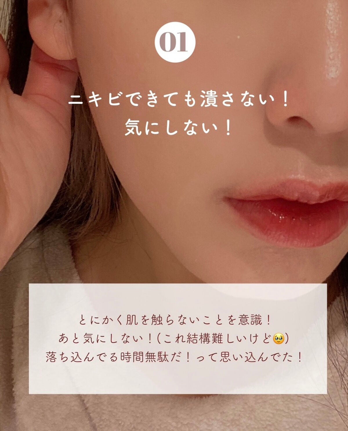 セラミドスキンケア 薬用アクネVCローション/エトヴォス/化粧水を使ったクチコミ(2枚目)