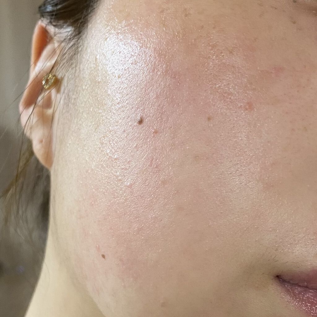 オーガニアンス ウォータリー エッセンス/primera/化粧水を使ったクチコミ（3枚目）