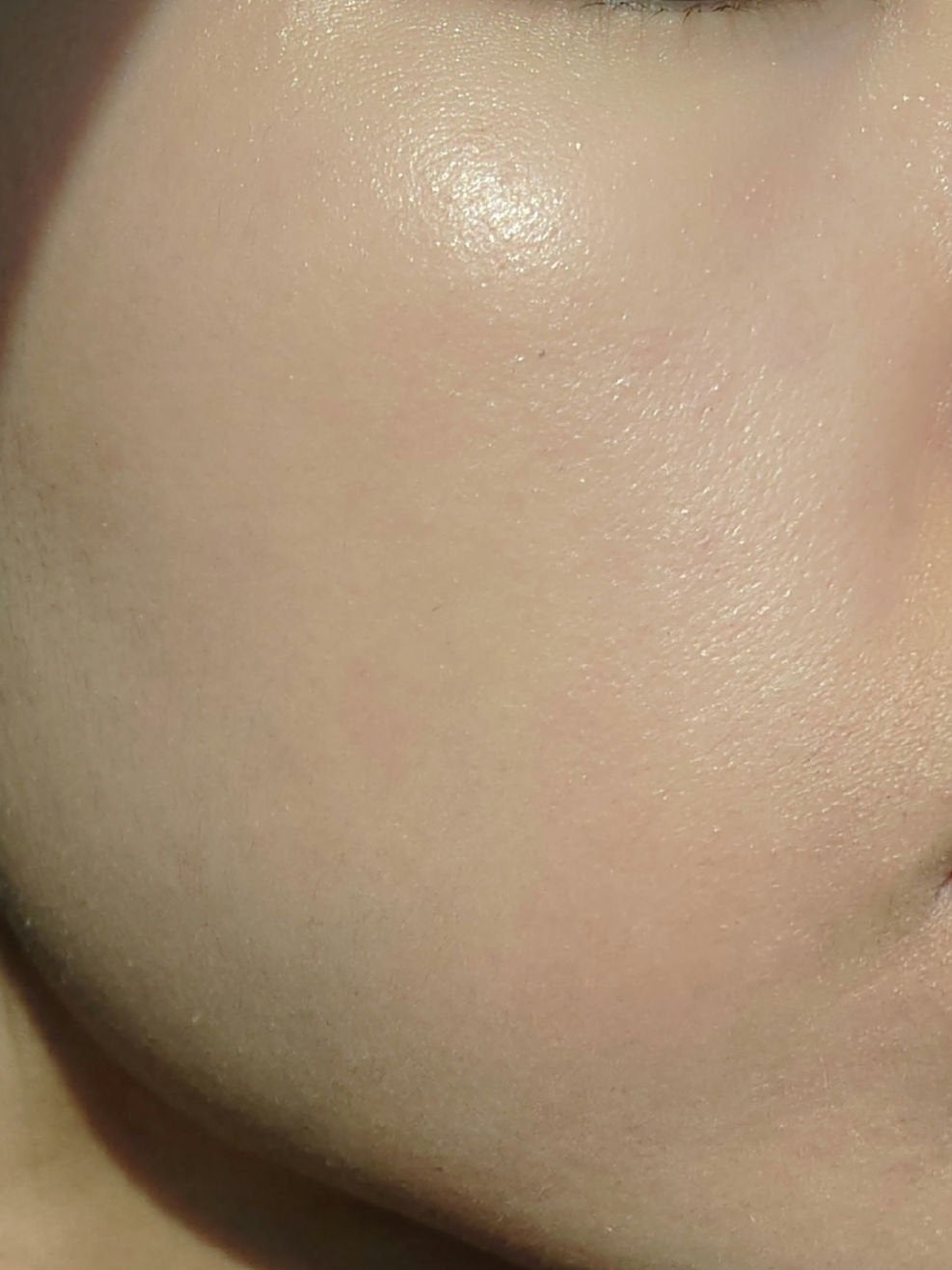 ããã³ ã¢ããã¢ã€ã¹ã ãšã€ãžã³ã°ã±ã¢ ãã€ã¯ãªãŒã UV/ããã³/æ¥çŒãæ¢ãã¯ãªãŒã ã䜿ã£ãã¯ãã³ãïŒ2æç®ïŒ