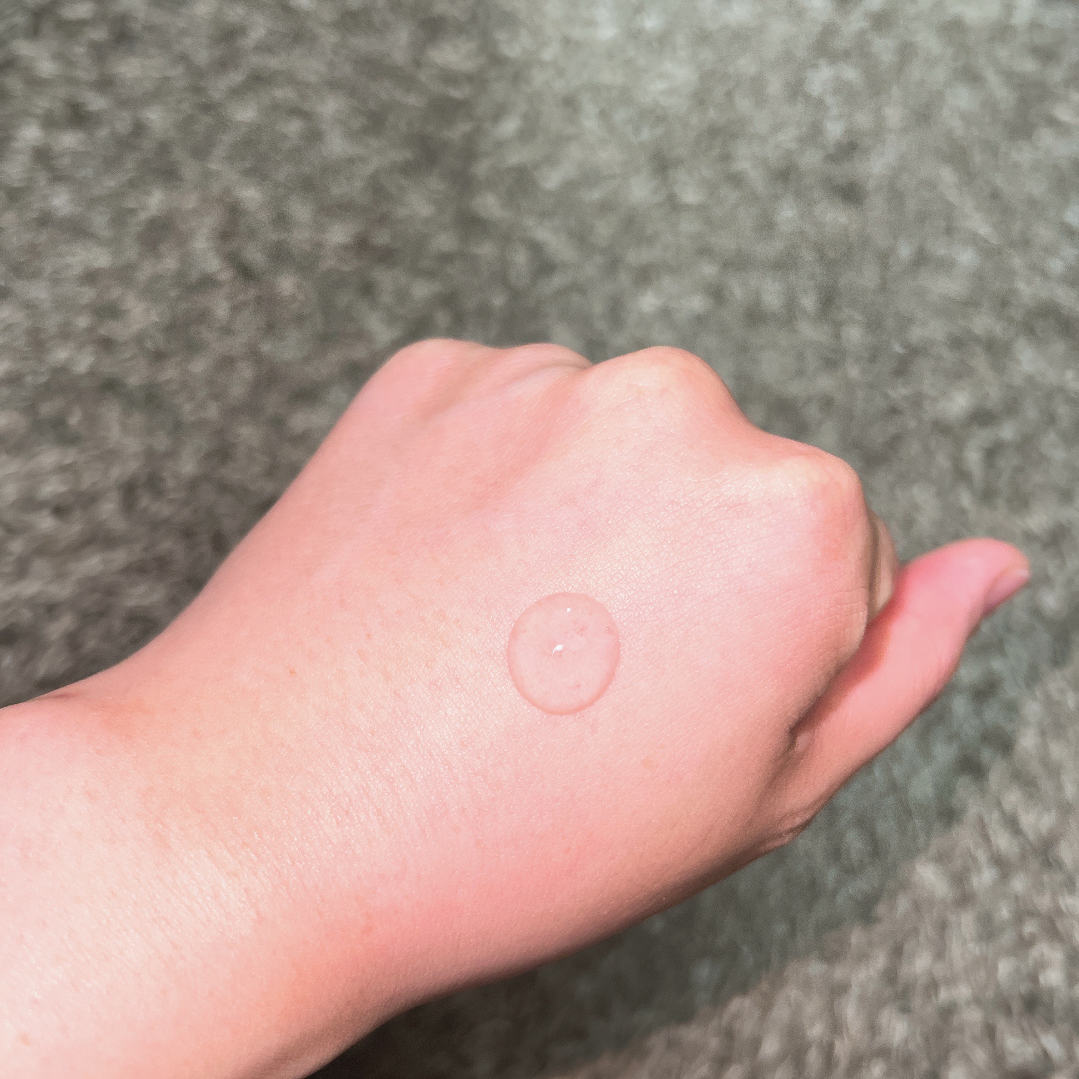 ピンクティーツリーシナジーセラム/APLIN/美容液を使ったクチコミ（2枚目）