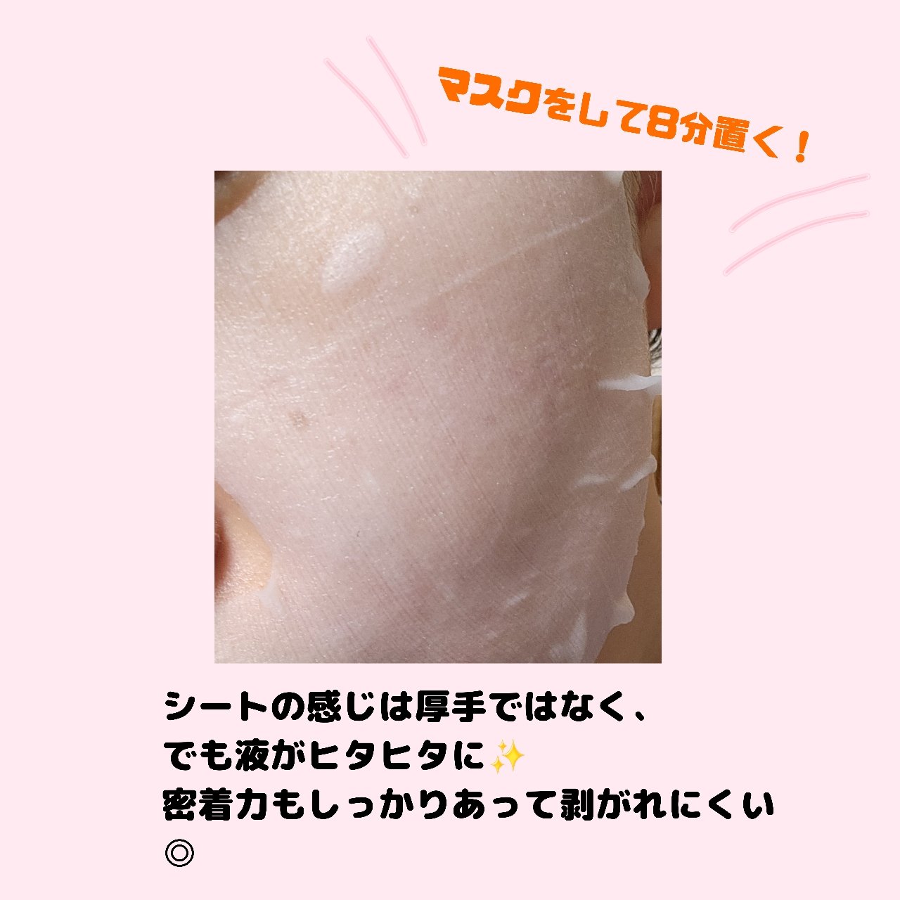 ごめんね素肌 キニナルマスク/クリアターン/シートマスク・パックを使ったクチコミ（2枚目）