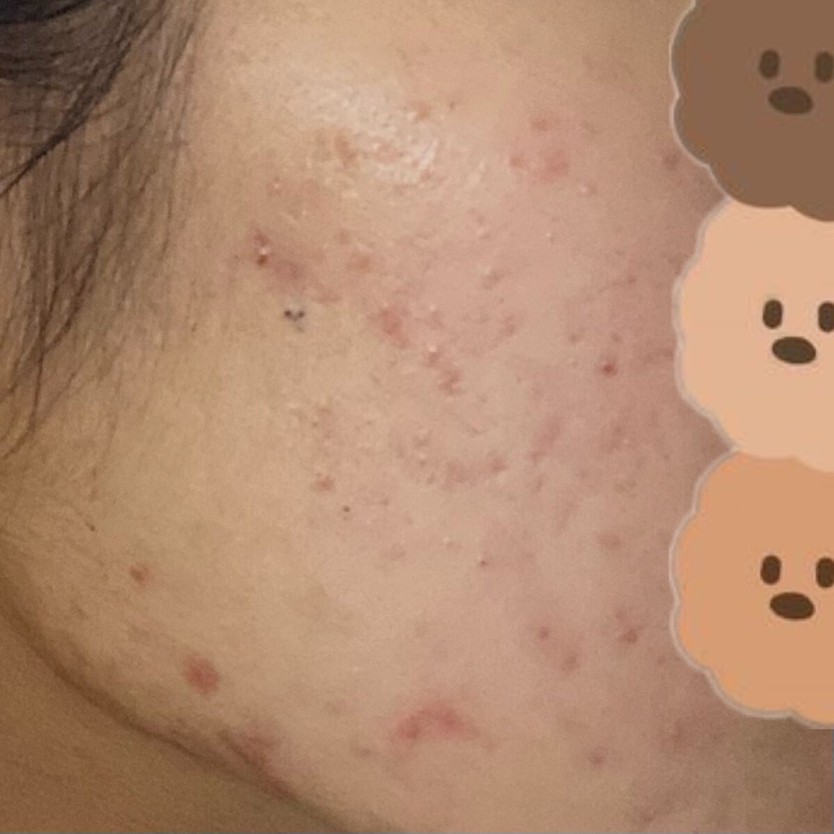 ガラクナイアシン2.0エッセンス/manyo/美容液を使ったクチコミ(5枚目)