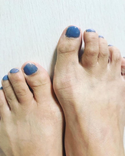 チャームスティックジェル/OMD/オールインワンネイルを使ったクチコミ(9枚目)