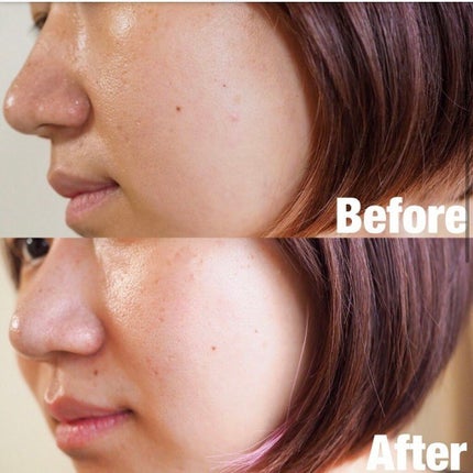 メラノフォーカスZ/HAKU/美容液を使ったクチコミ(2枚目)