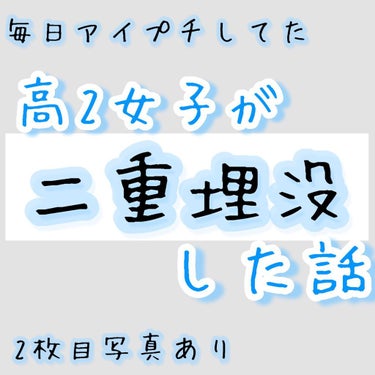 アイビューティー フィクサー WP/アストレア ヴィルゴ/二重まぶた用アイテムを使ったクチコミ（1枚目）