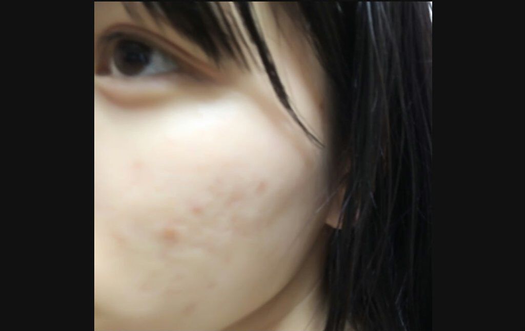 スキンケア洗顔料 薬用アクネケア/ビオレ/洗顔フォームを使ったクチコミ(1枚目)