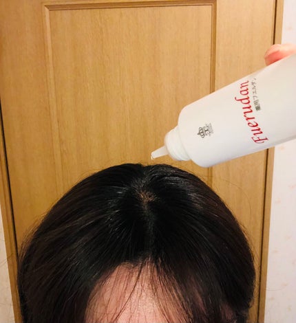 薬用育毛剤フエルダン/リムサプライ/頭皮ローションを使ったクチコミ(4枚目)