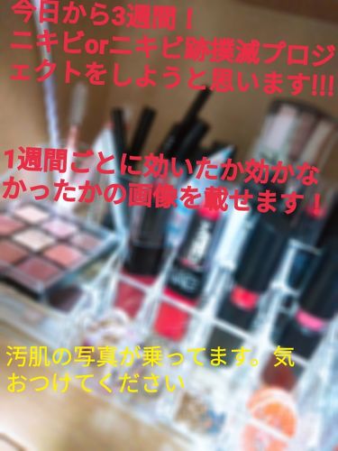 ビタミンbミックス Dhcを使った口コミ 2度目の登場 あお どぅえす今 By 草通り越して花鼻咲き誇って夢 脂性肌 10代前半 Lips ビタミンbミックス Dhcを使った口コミ 2度目の登場 あお どぅえす今 By 草通り越して花鼻咲き誇って夢 脂性肌 10代前半 Lips