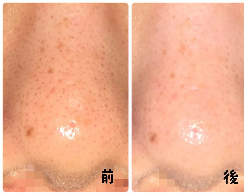 クレンジングオイル/ラメランス/オイルクレンジングを使ったクチコミ(3枚目)