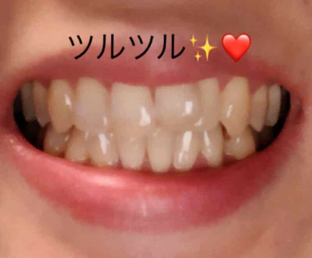 イオン音波振動歯ブラシ IONPA/KISS YOU/電動歯ブラシを使ったクチコミ(2枚目)