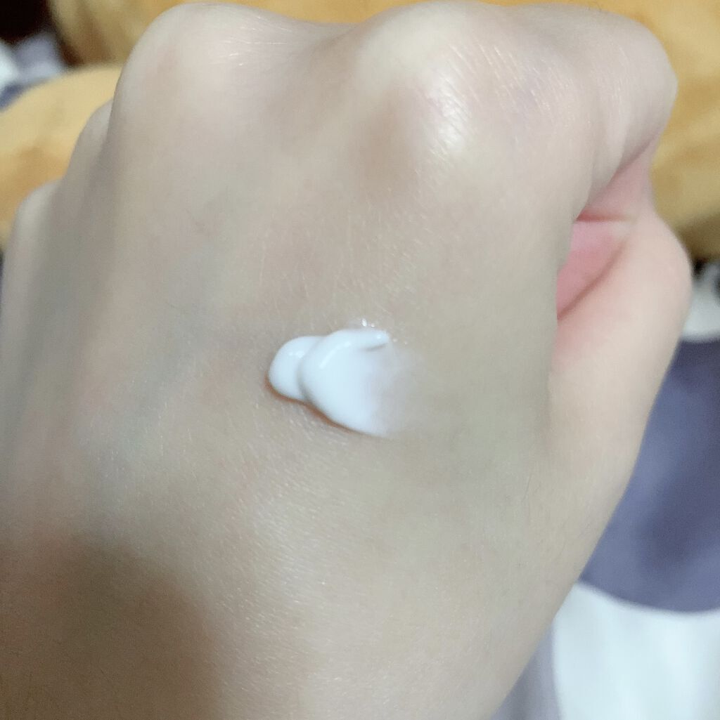 アットノンEX クリーム(医薬品)/アットノン/その他を使ったクチコミ（3枚目）