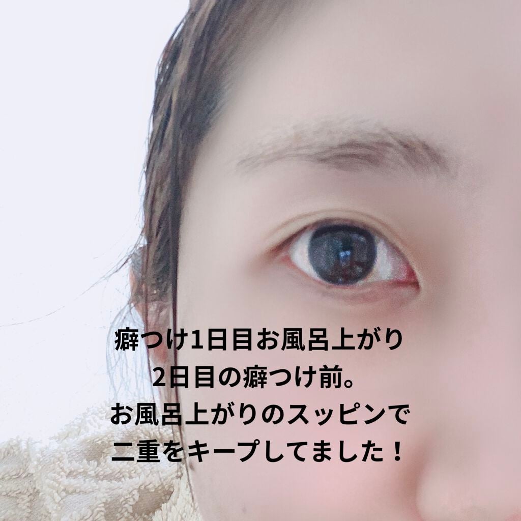 ERN on LIPS 「こんにちは〜💭今回は先日から遂に二重の癖つけを始めたのでその際..」(3枚目)