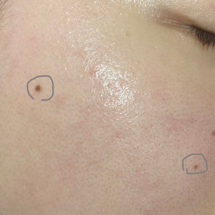 モイストバランス  ローション/ACSEINE/化粧水を使ったクチコミ(3枚目)