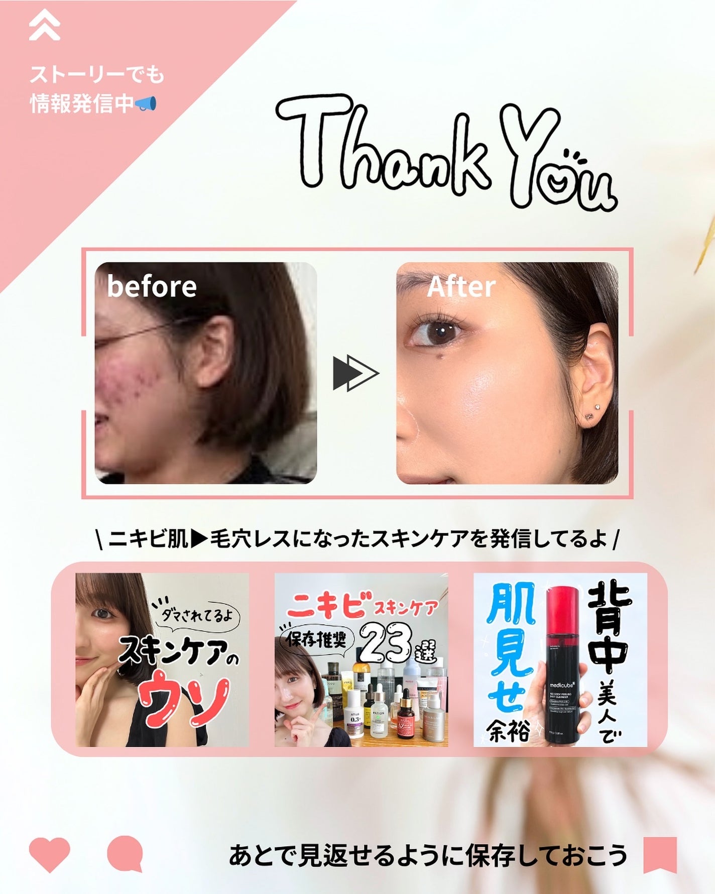 なぎ | スキンケア薬剤師 on LIPS 「◀︎ニキビ肌から毛穴レスになった薬剤師どこのシャンプー?って聞..」(8枚目)