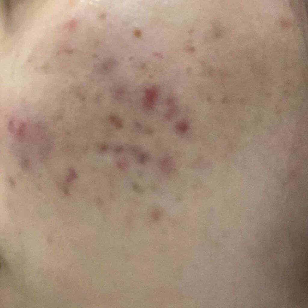 キールズ DS クリアリーブライト エッセンス[医薬部外品]/Kiehl's/美容液を使ったクチコミ（3枚目）