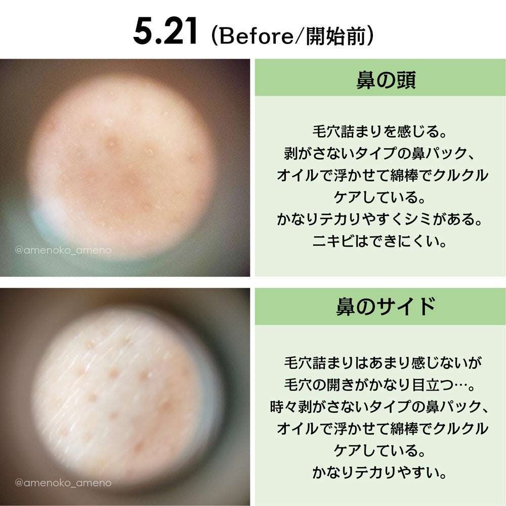 CICA クリーム/VT/フェイスクリームを使ったクチコミ(5枚目)