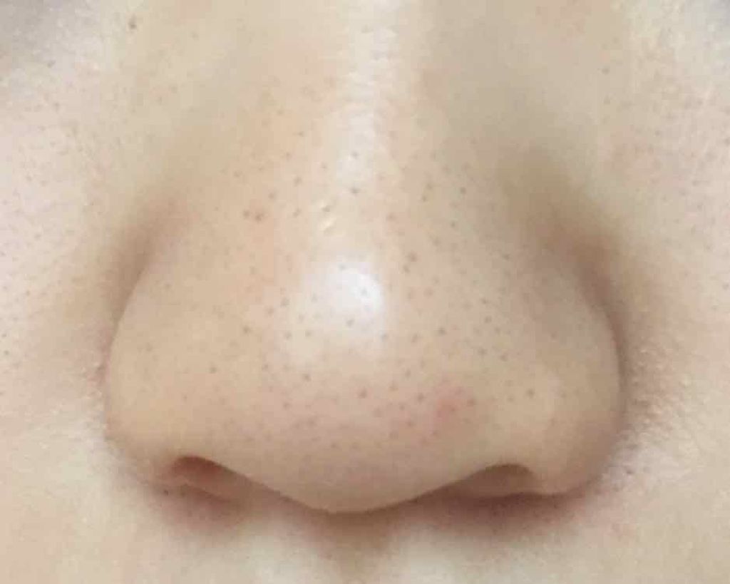 ハトムギ化粧水(ナチュリエ スキンコンディショナー R )/ナチュリエ/化粧水を使ったクチコミ(2枚目)