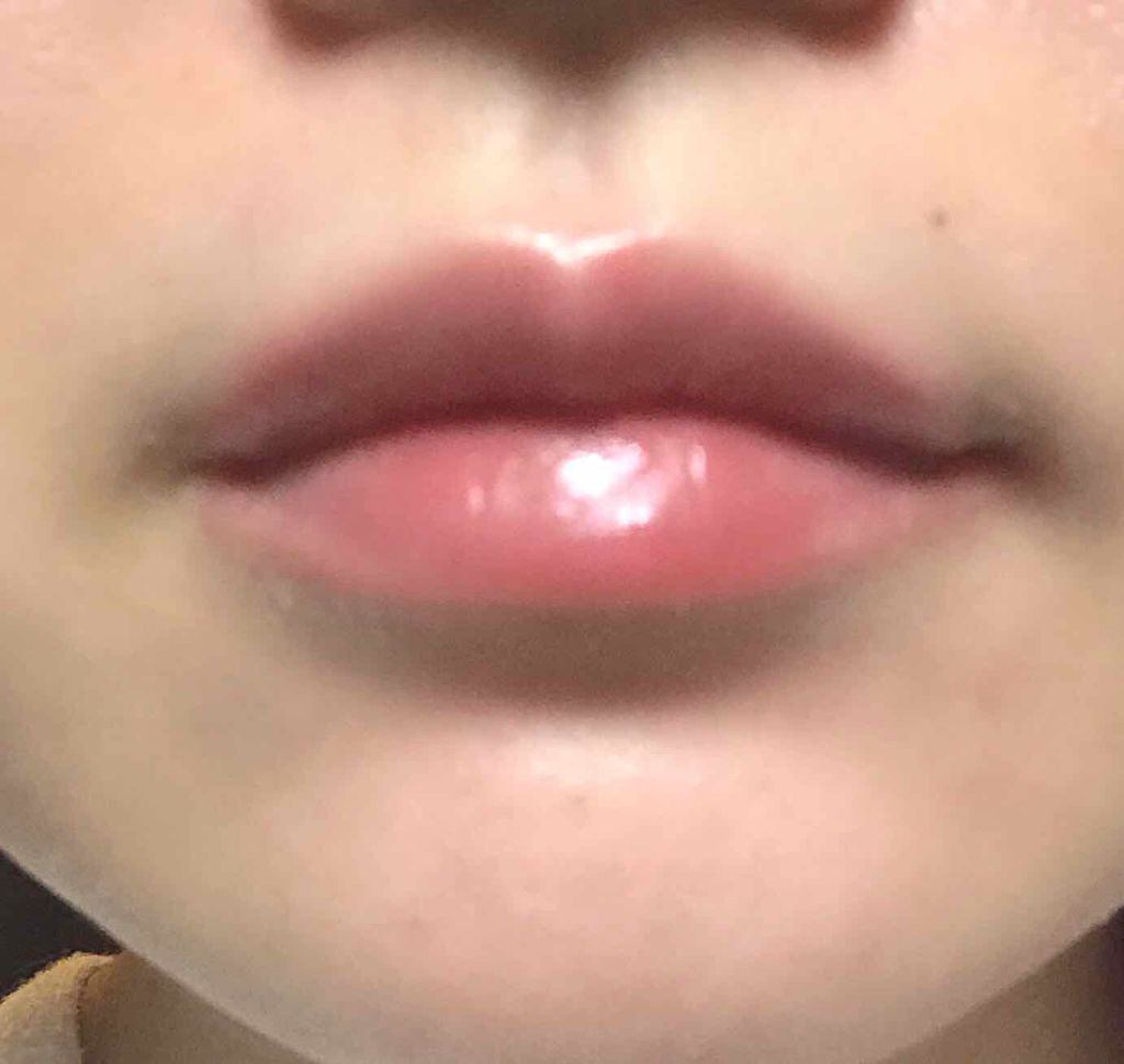 ハニーリップゴマージュ/VECUA/リップケアを使ったクチコミ(4枚目)