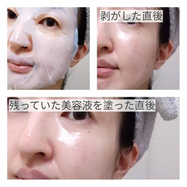 スキンオアシスマスク /yuhia /シートマスク・パックを使ったクチコミ（4枚目）