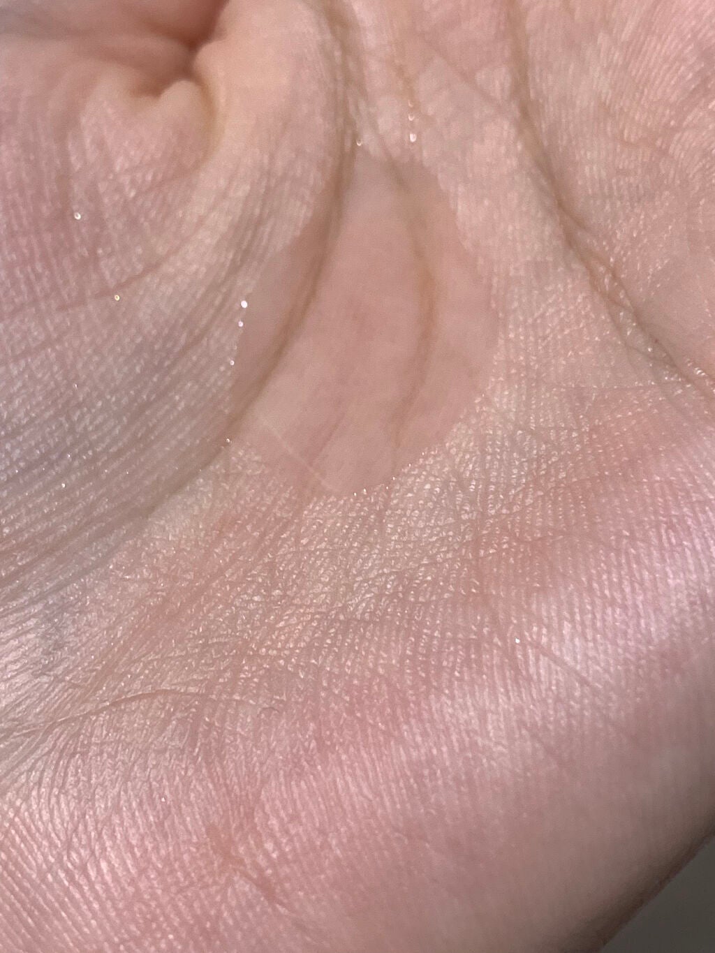 ピンクティーツリートナー/APLIN/化粧水を使ったクチコミ(2枚目)