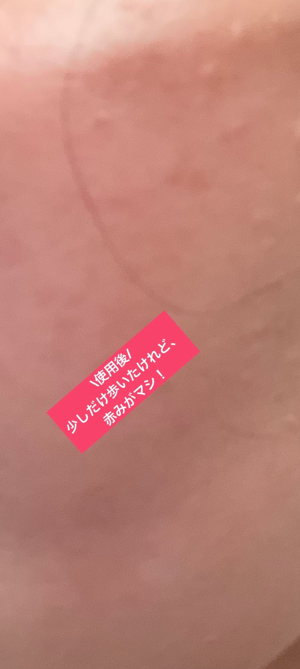 ラディアント タッチ グロウパクト/YVES SAINT LAURENT BEAUTE/クッションファンデーションを使ったクチコミ(2枚目)