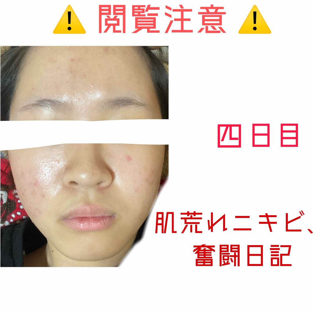 を使ったクチコミ（1枚目）