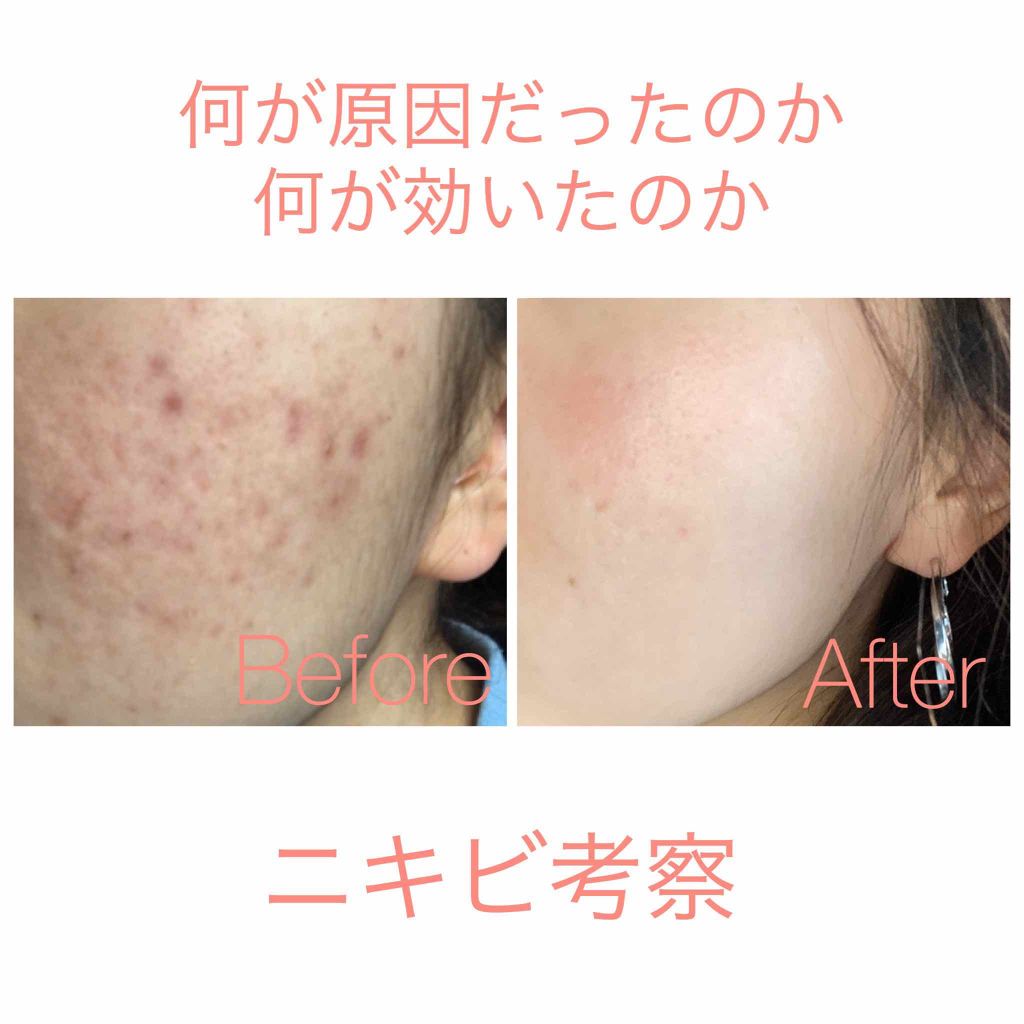 ハトムギ化粧水(ナチュリエ スキンコンディショナー R )/ナチュリエ/化粧水を使ったクチコミ（1枚目）