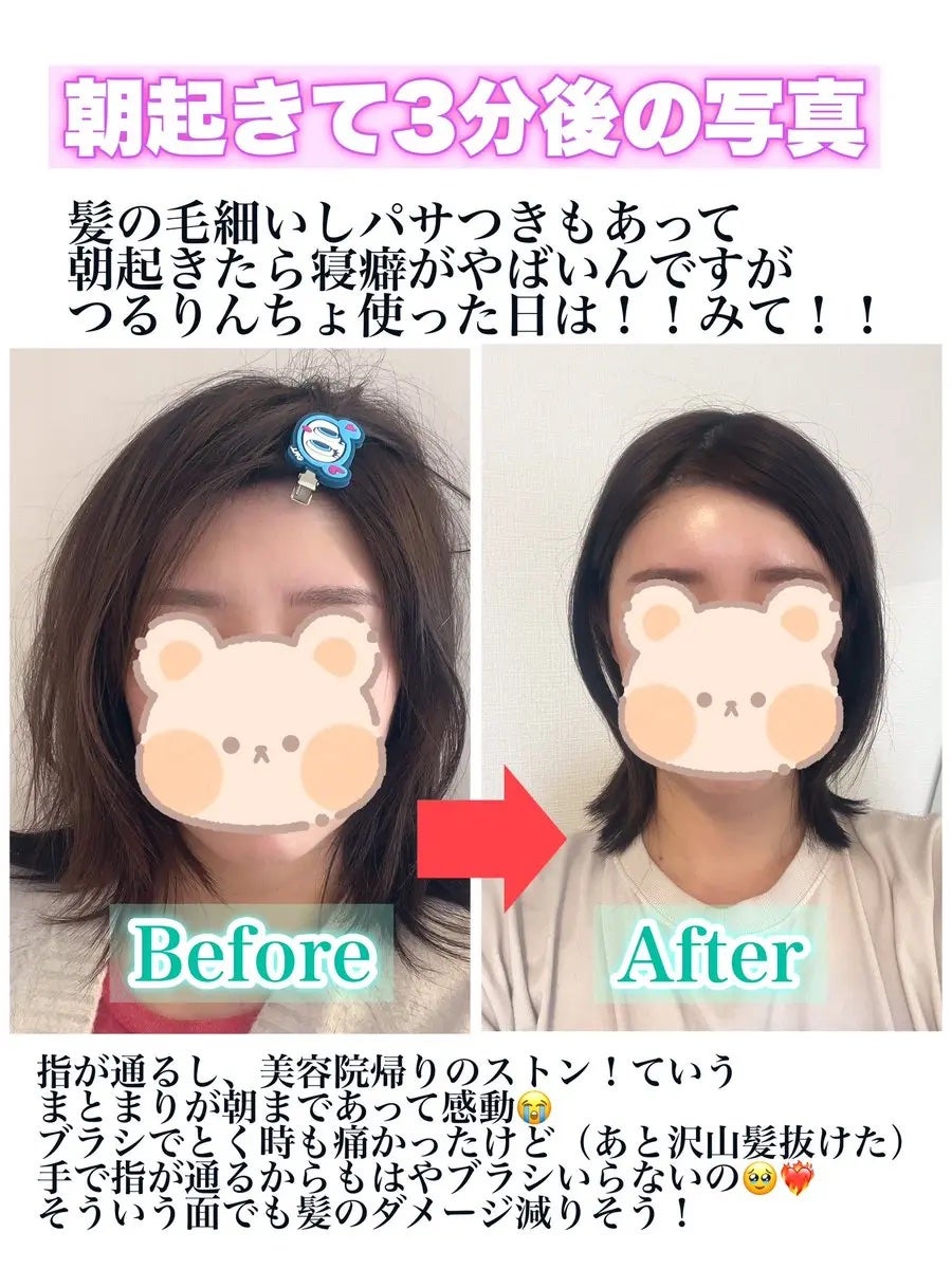 つるりんちょ シャンプー / トリートメント/つるりんちょ/市販シャンプーを使ったクチコミ(2枚目)